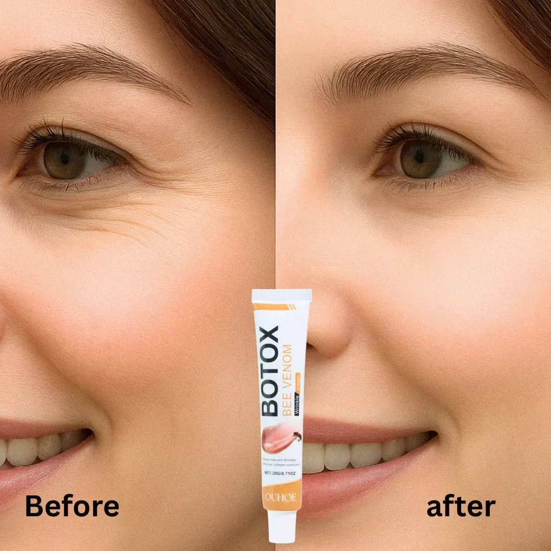 OUHOE Bee Venom Wrinkle Cream